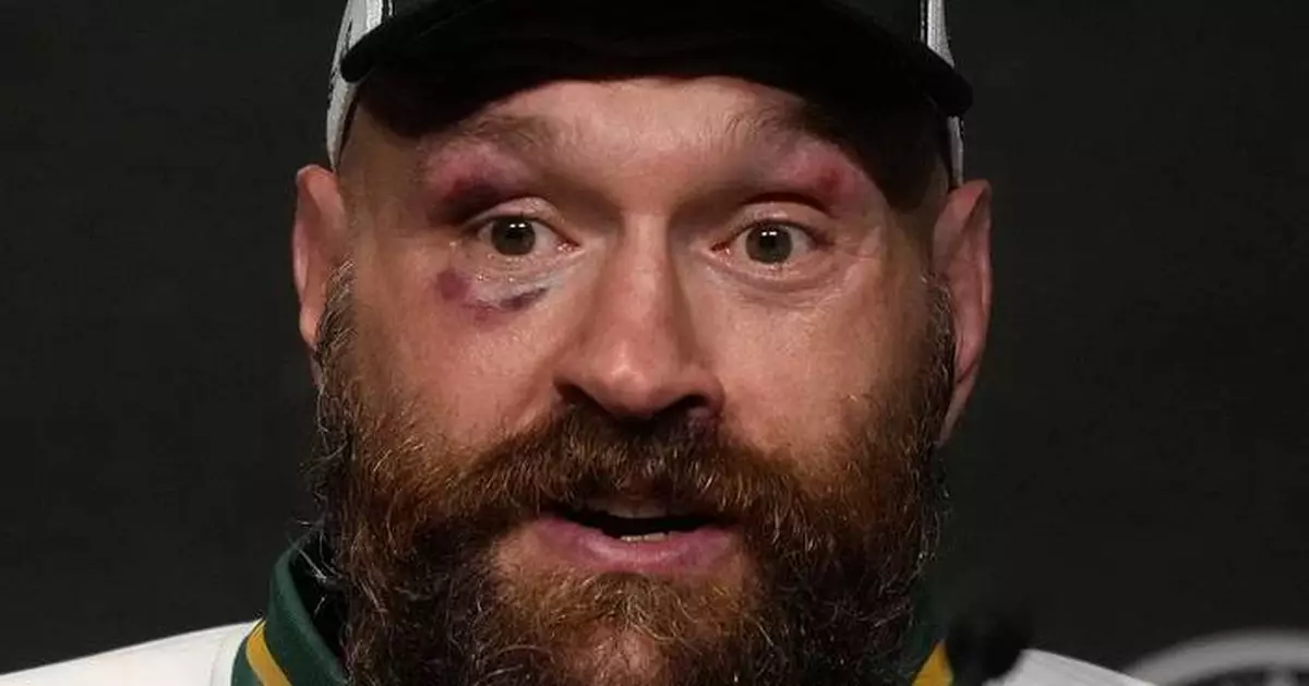 Tyson Fury says he is coming out of retirement in 2026