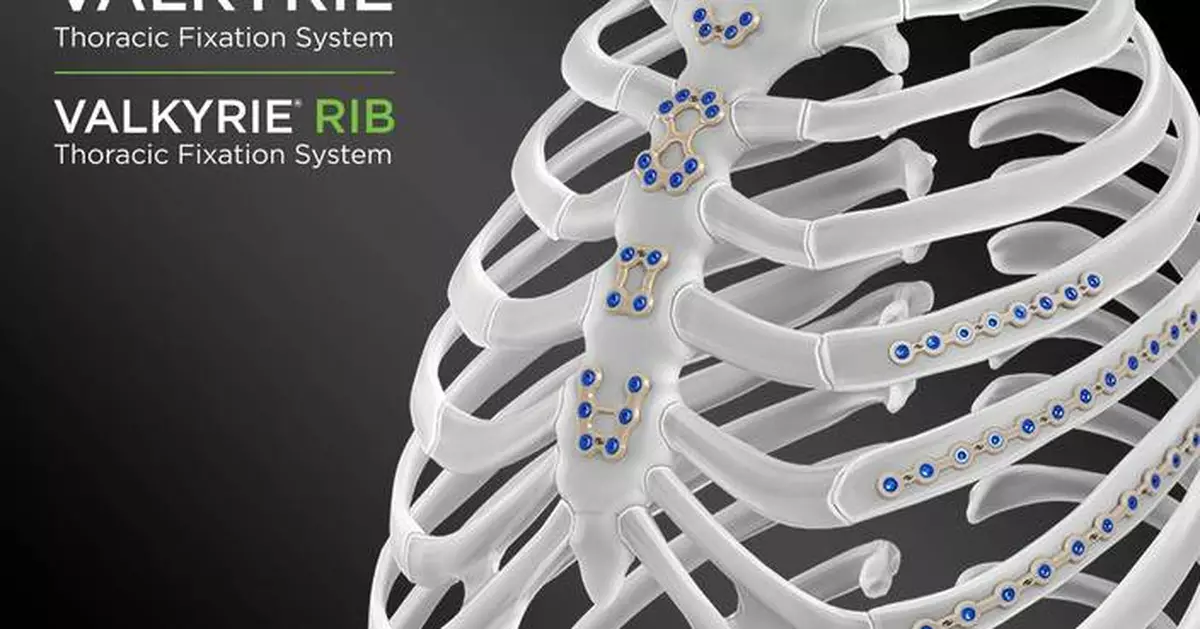 Able Medical to Showcase Industry’s First-to-Market PEEK Sternal Closure System at STS
