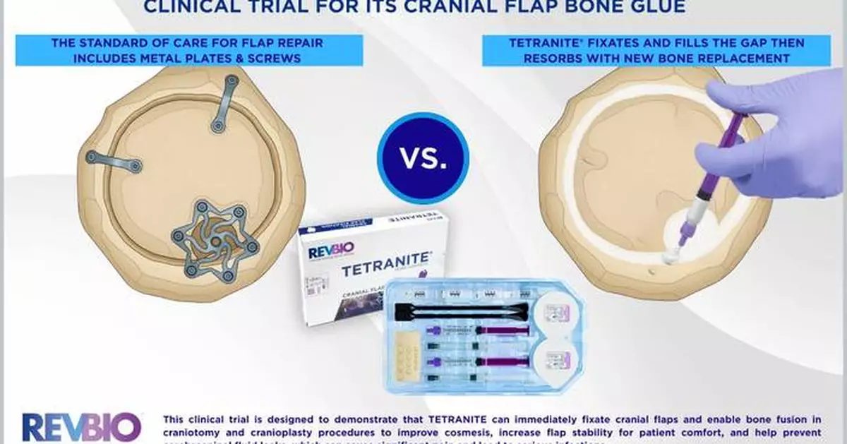 FDA Greenlights RevBio’s Pivotal Clinical Trial for its Cranial Flap Bone Glue