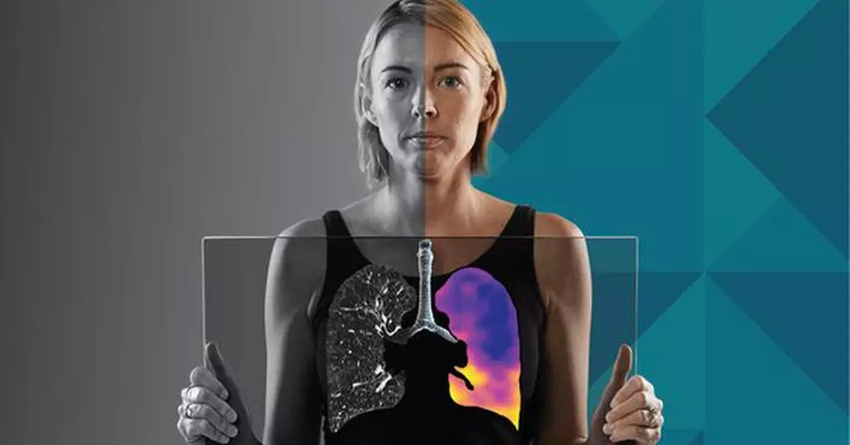 4DMedical Secures US$100+ Million Funding to Accelerate U.S. Expansion and increase Technology Dominance in Software-Based Lung Imaging