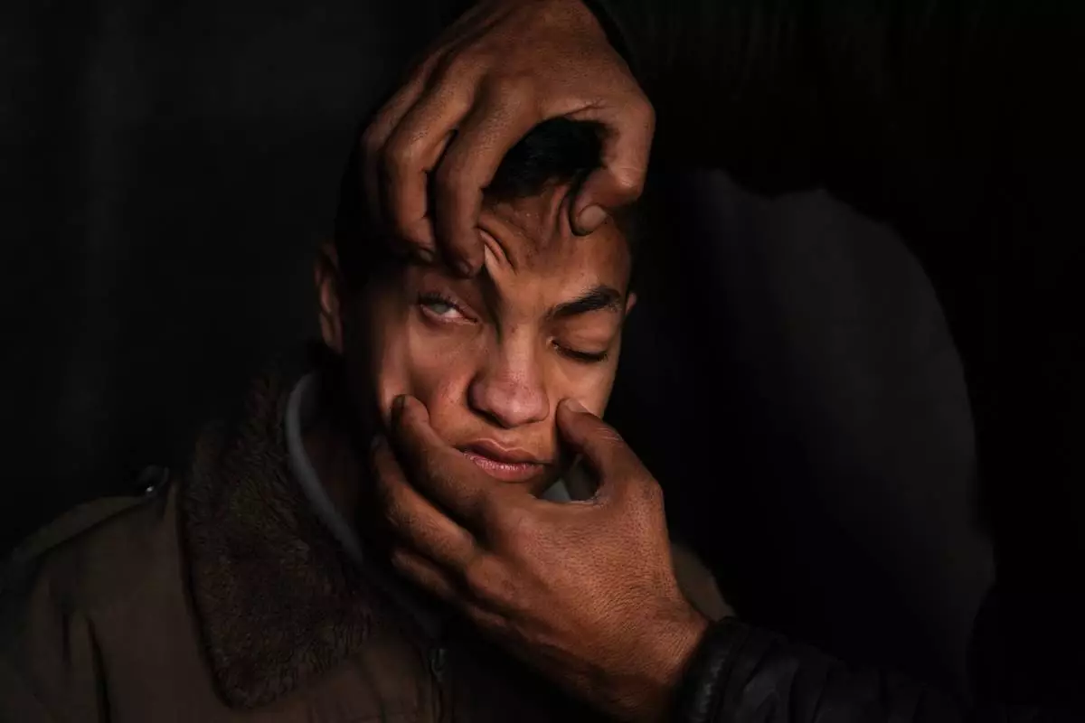 FILE - Mahmoud Abu Ishaq, 14, who is suffering vision loss due to a corneal condition, has his eye shown to the camera by his father as they await permission to travel outside the Gaza Strip for medical treatment, in Khan Younis, Jan. 27, 2026. (AP Photo/Abdel Kareem Hana, File)