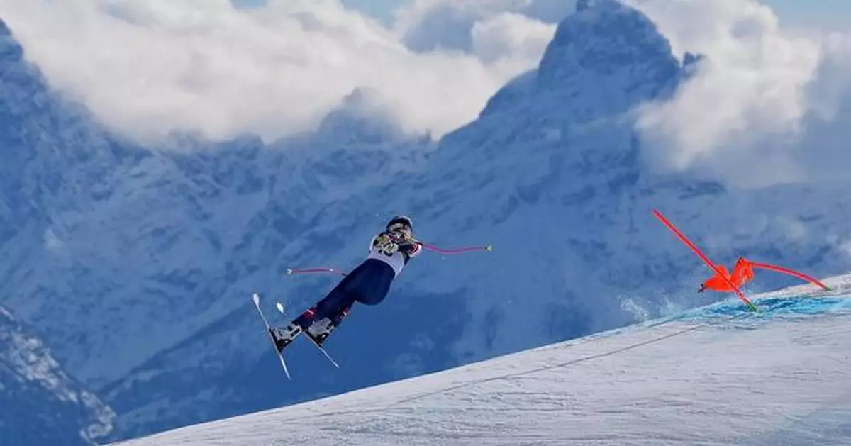 Lindsey Vonn has more surgery after Olympic crash. 'I’m bionic for real now'