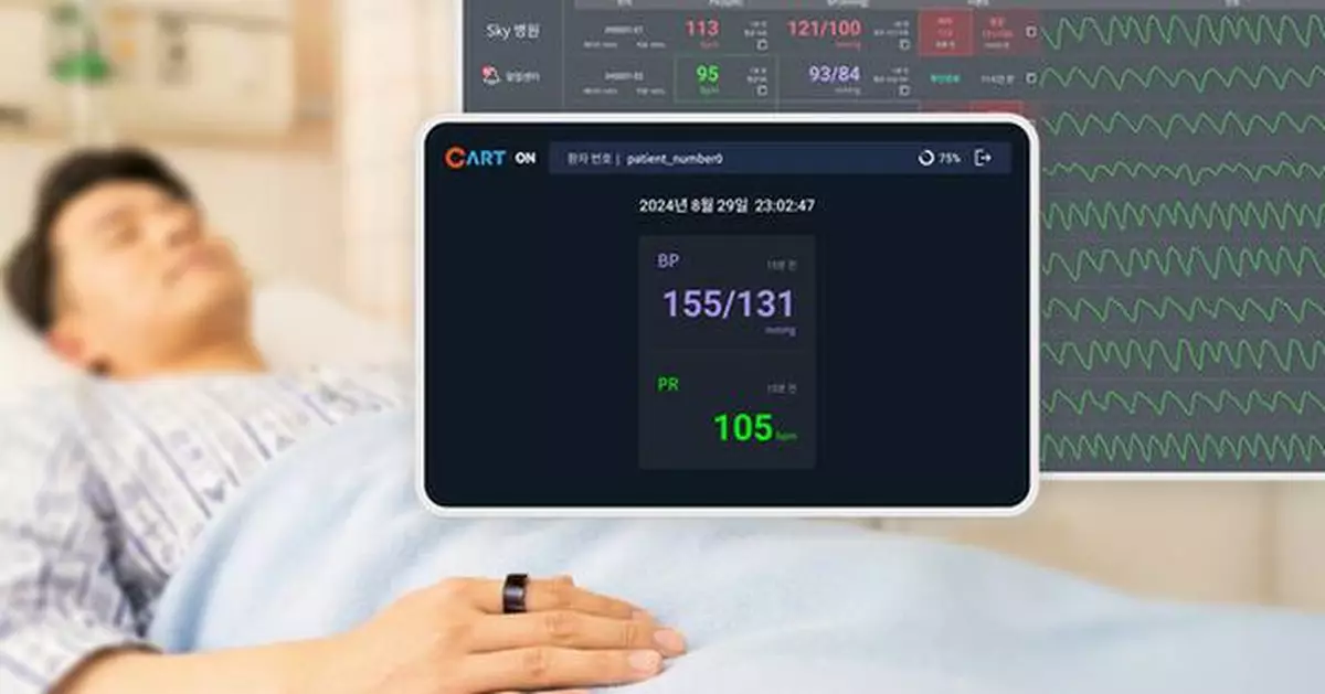Sky Labs Launches 'CART ON', the World's First Ring-Type Wearable Blood Pressure Monitoring Solution for Hospital Wards