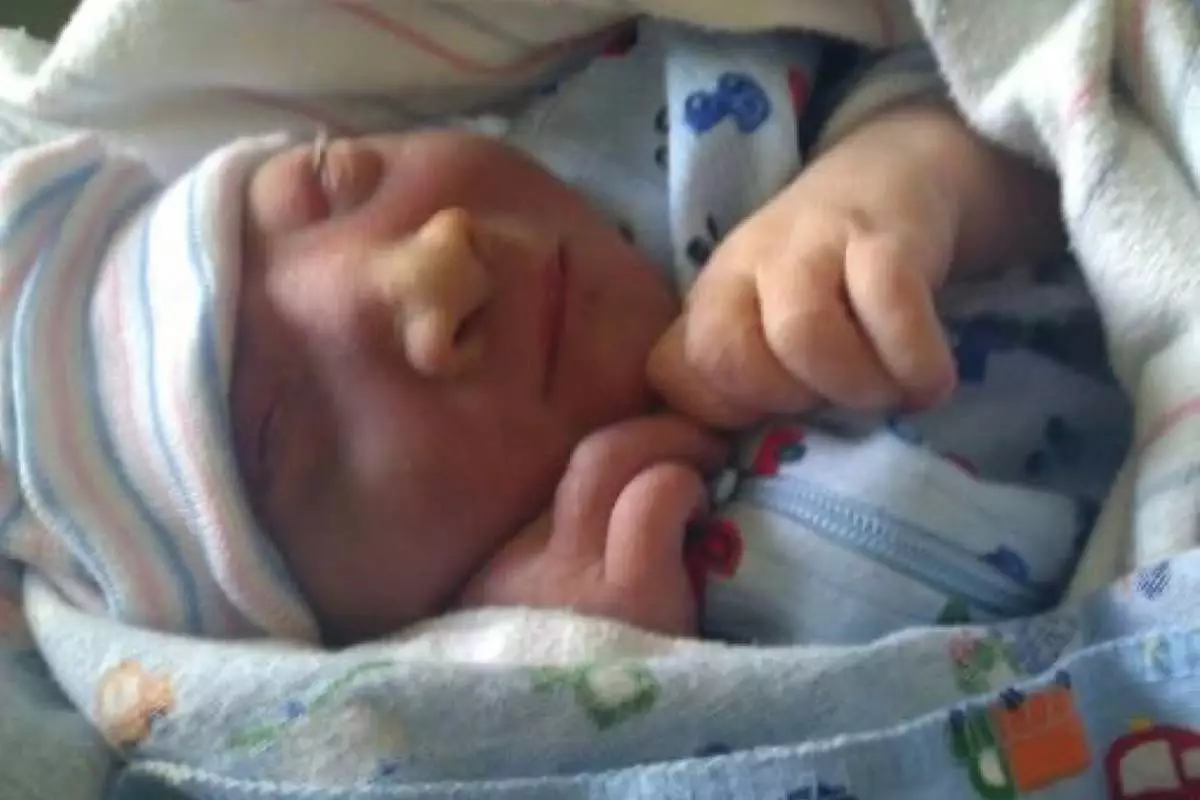 This photo provided by Andrea Lopez shows her son, Gabriel Crude, at a hospital Bakersfield, Calif., in 2011, where he was born with anencephaly, a rare and severe birth defect tied to a lack of folic acid, a key vitamin. (Courtesy Andrea Lopez via AP)