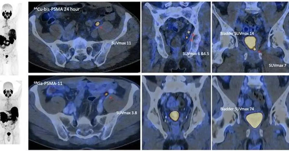 Co-PSMA data presented at EAU Annual Congress 2026 with manuscript accepted for publication in the European Urology journal