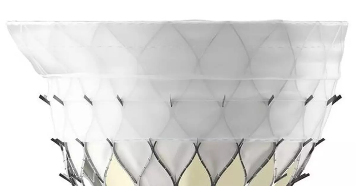 First Implant of KingstronBio's ProStyle M® Transcatheter Mitral Valve System Successfully Completed in National Multicenter Confirmatory Study