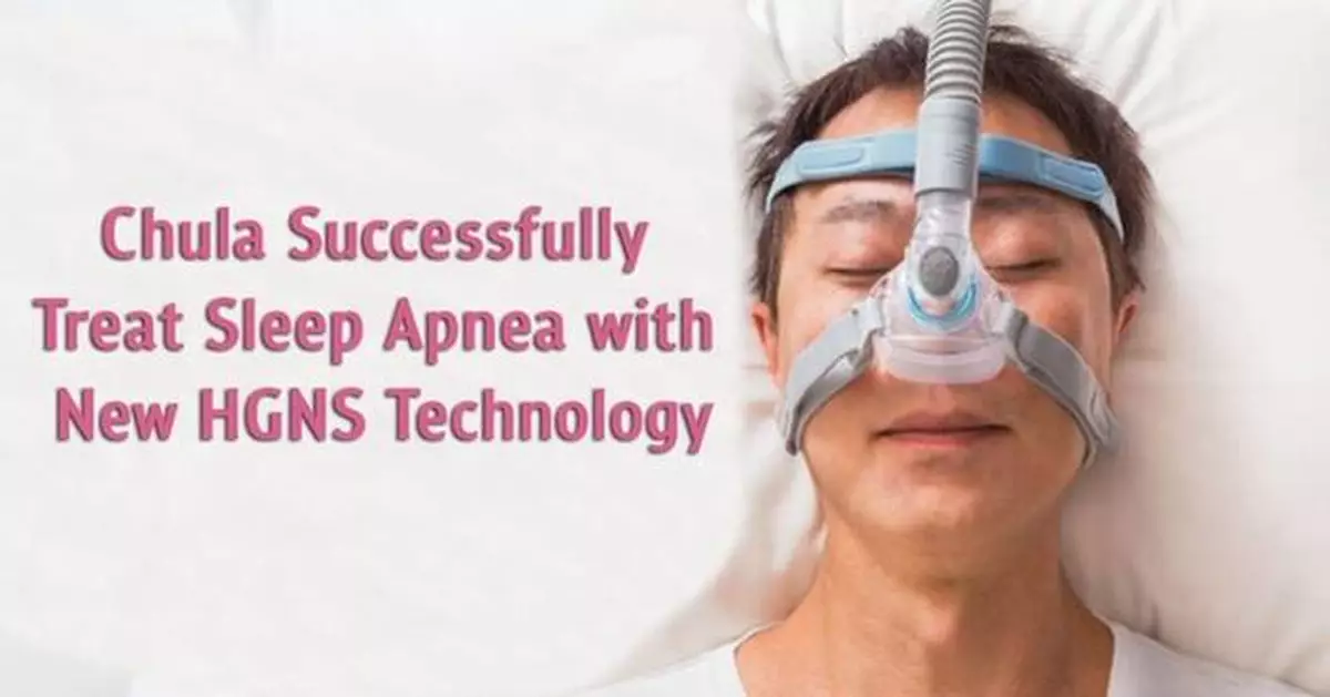 Chulalongkorn University doctors successfully performed surgery for obstructive sleep apnea using the new HGNS technique the fourth successful surgery of this kind in Asia