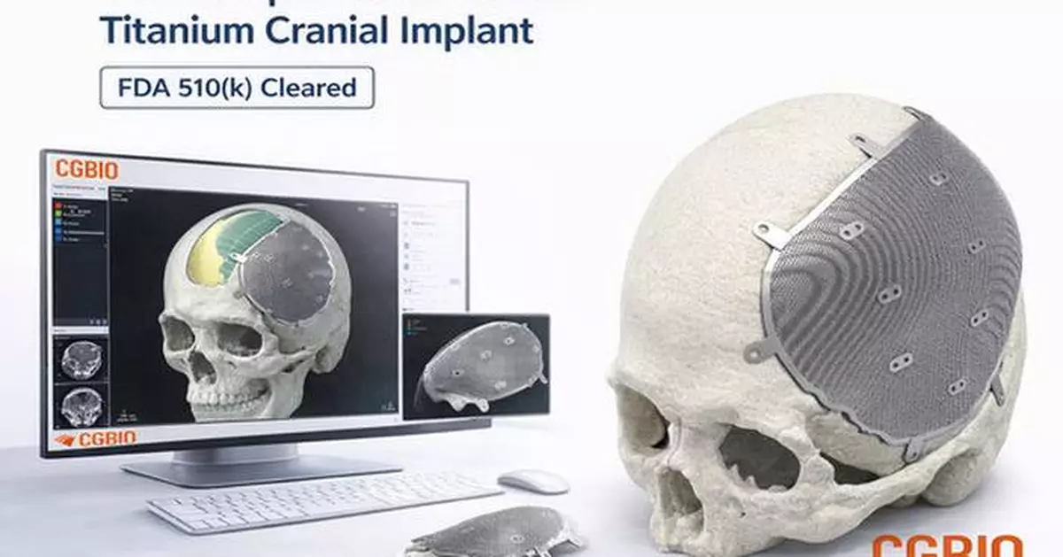 CGBIO Receives FDA 510(k) Clearance for Patient-Specific Titanium Implant 'EASYMADE TI'