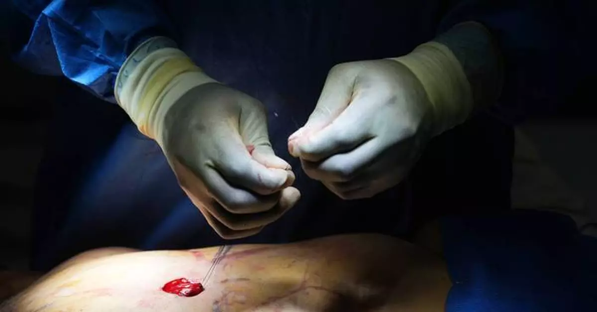 Cosmetic interventions are booming. Many say ethical conversations are lagging