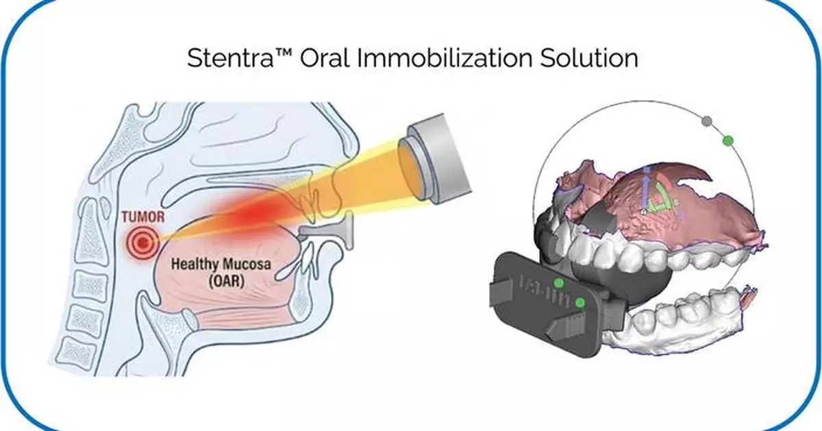 Kallisio Stentra™ Named “Best New Radiology Technology Solution” in 2026 MedTech Breakthrough Awards Program