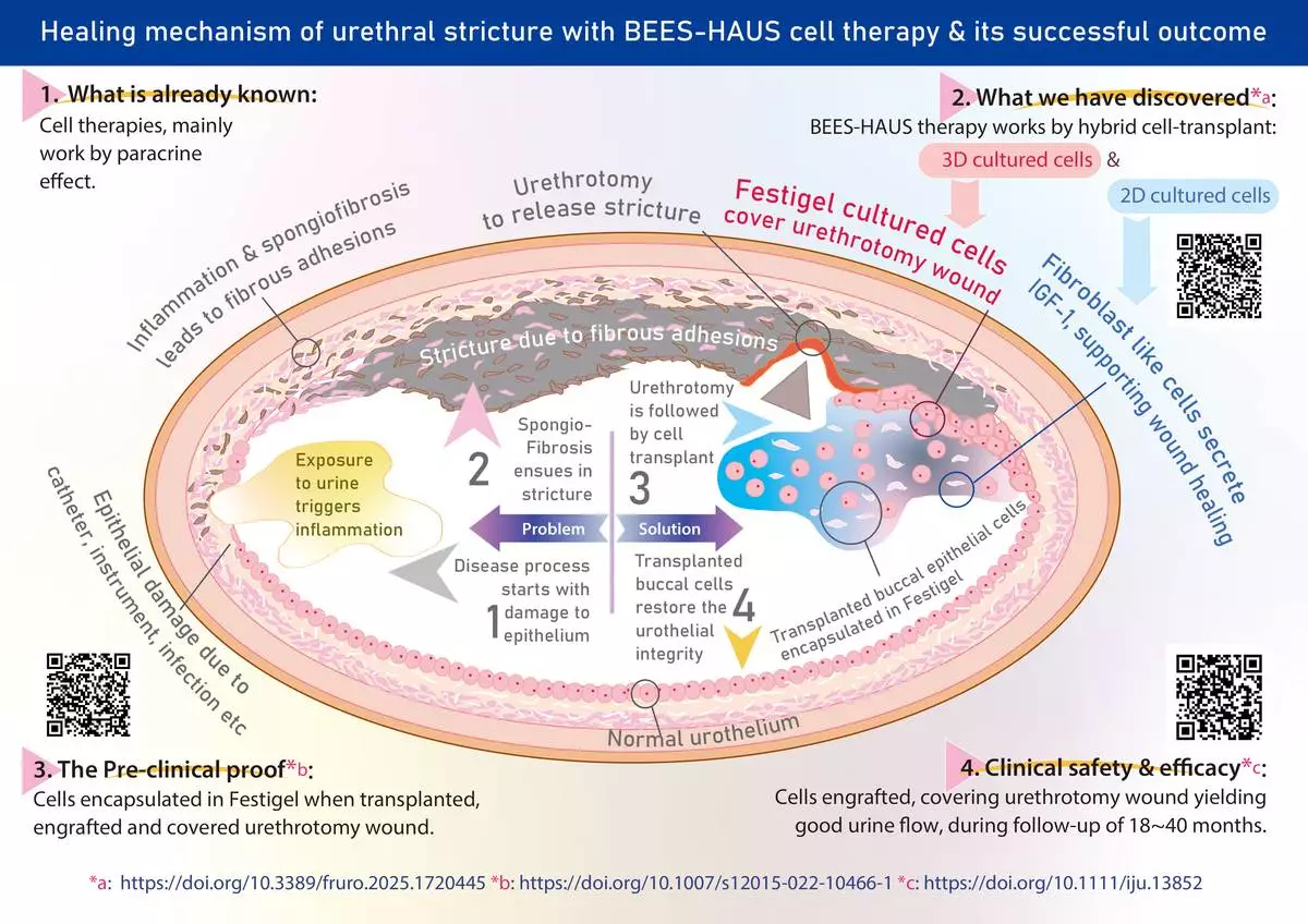 Urethral stricture starts with narrowing of a short segment of urethral lumen. At early stages, it is managed by balloon dilatation or DVIU Urethrotomy. The open urethrotomy wound after dilatation or DVIU has to heal from the edges of the wound, which may take a longer time. In BEES-HAUS cell therapy, the cell transplant having proven successful engraftment, covering the urethrotomy wound, yielding clinical safety and efficacy may be considered to be included in the treatment guidelines after validation. Its simplified version, the BHES-HAUS (Buccal epithelium Hashed and Encapsulated in Scaffold—Hybrid Approach to Urethral Stricture) accomplished in one-go without need for cell culture in a lab, works on similar principles. After long term follow-up, BHES-HAUS minimally invasive approach may be worth combining with DVIU and balloon dilatation, as it may be able to provide longer duration of recurrence-free, good quality of life without need for intermittent self-catheterization.