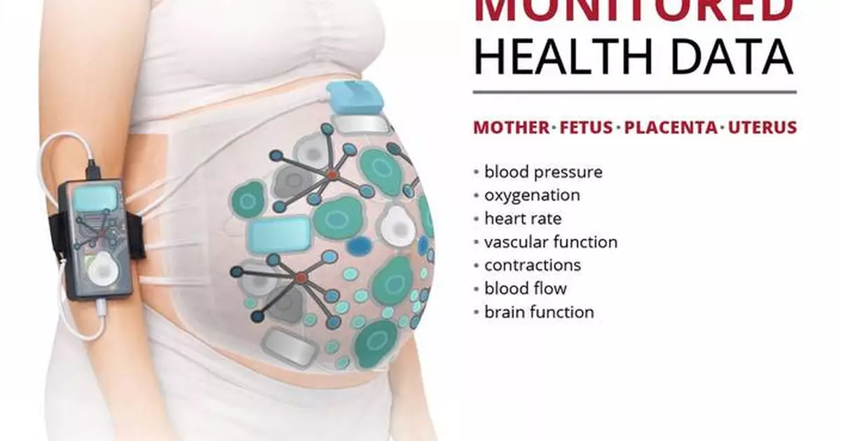 Carnegie Mellon Team Awarded ARPA-H Contract to Transform Care During Labor and Childbirth