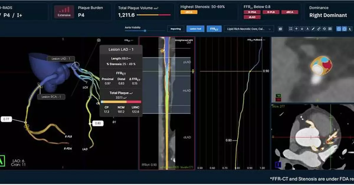 Elucid to Showcase CCTA Vision at SCCT 2026, Defining the Future of Personalized Cardiovascular Care