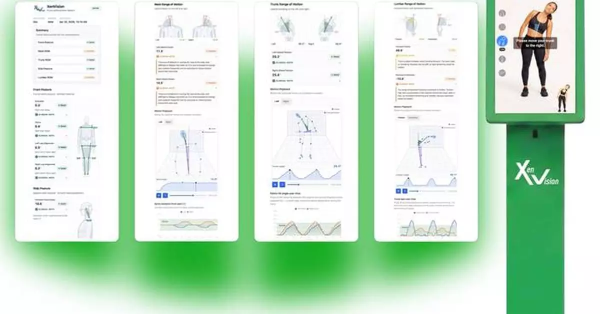Xenco Medical Unveils XenVision, an AI-Driven Musculoskeletal Health Breakthrough at SIGGRAPH 2026, the World’s Premier Computer Graphics Conference
