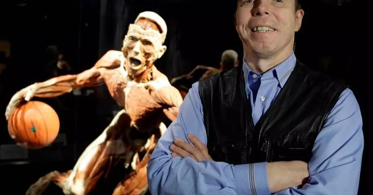 Gunther von Hagens, the German anatomist behind the 'Body Worlds' exhibition, dies at 81