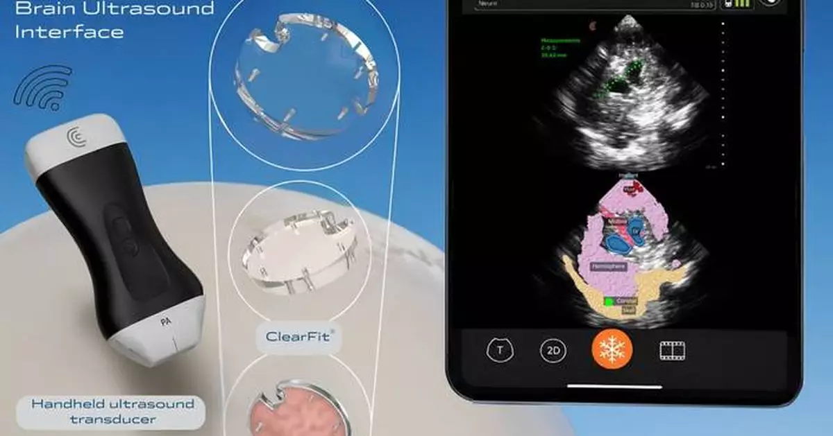 Longeviti Launches ClearFit AI™, a Brain Ultrasound Interface (BUI) to Advance Platform Solutions for Neurological Disorders