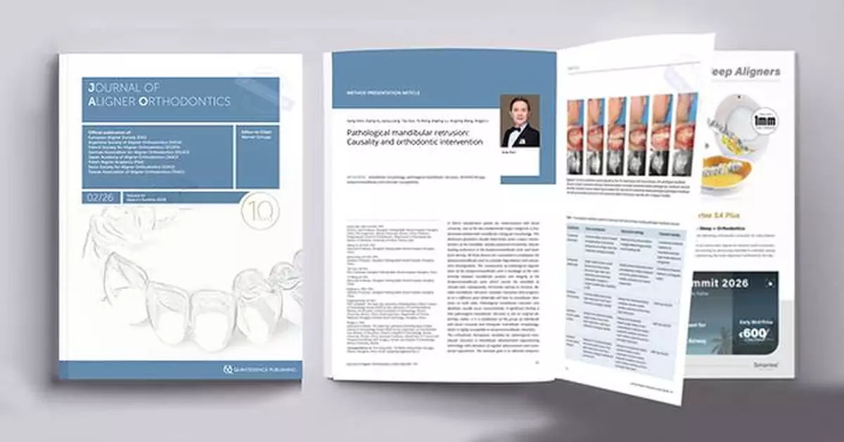 Professor Gang Shen's Orthodontic Team Publishes Third Consecutive Paper in the Journal of Aligner Orthodontics