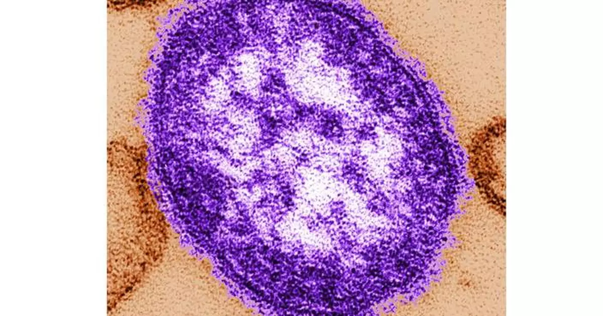 Pennsylvania reports first 2 measles deaths in the US this year, both people unvaccinated