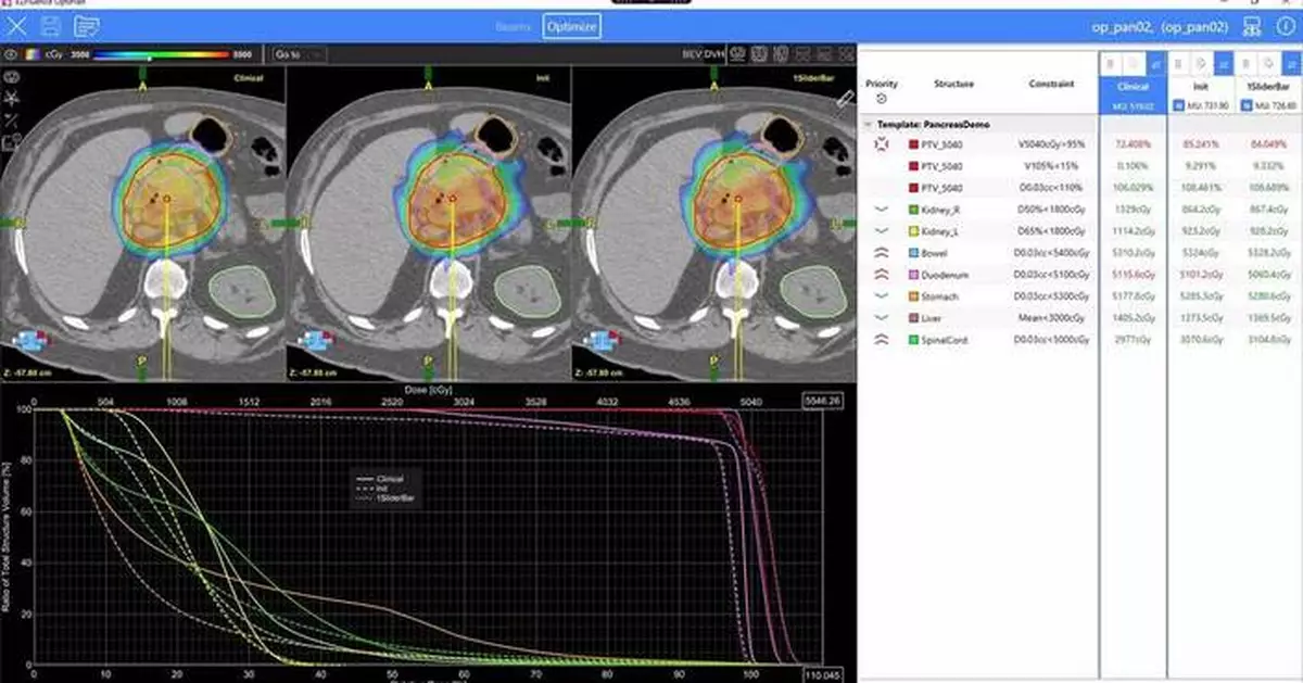 Radformation Receives USFDA 510(k) Clearance for OptiPlan Automated VMAT Planning