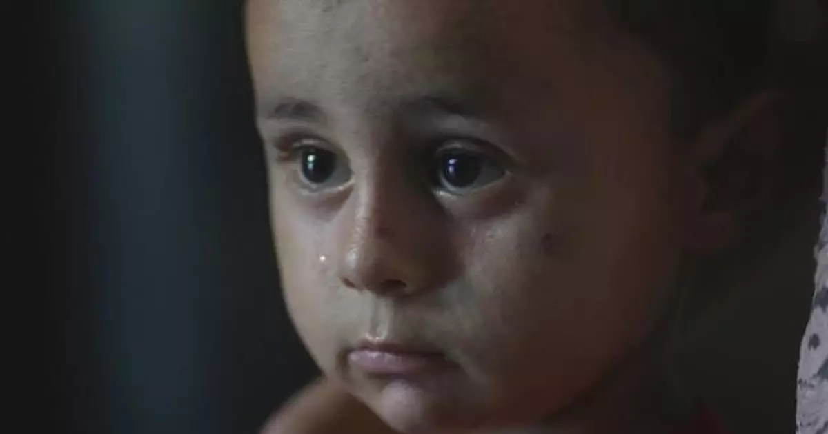 Children face skin disease crisis in Gaza tent camps