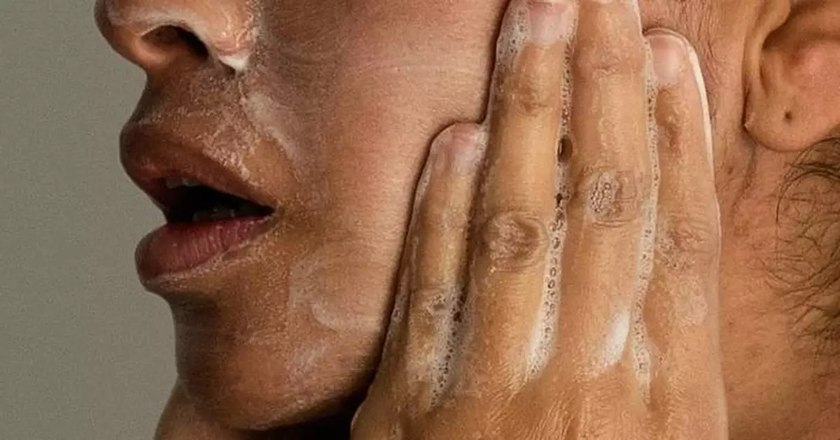 Adult acne is real, but there are ways to treat it. Here's what to know