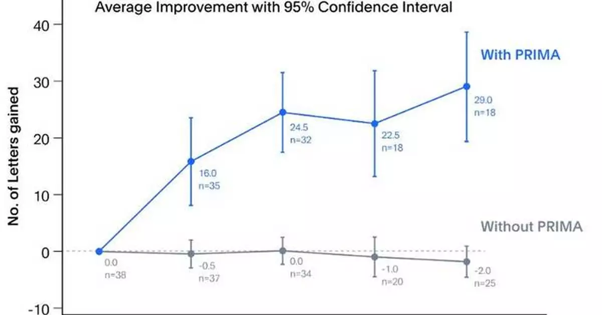 Science Corp. Announces Long-Term (36 Months) Results of PRIMA BCI Clinical Trial Showing Durable Vision Restoration in Blind Patients Suffering from Geographic Atrophy
