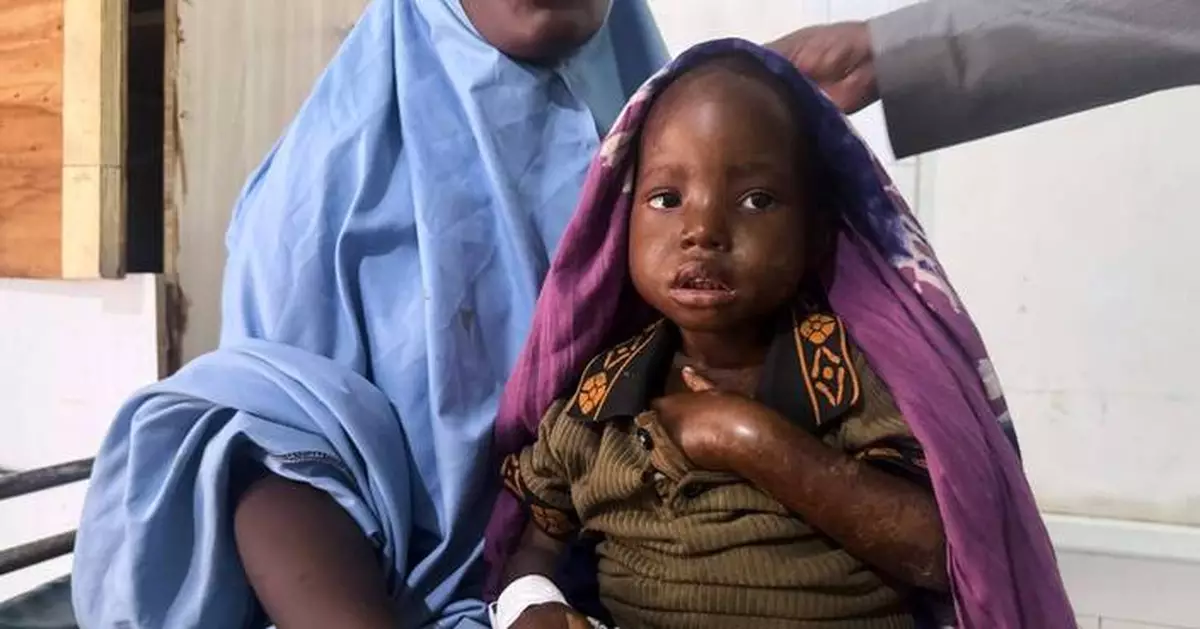 Mother's 3-day walk with sick daughter highlights Somalia's child malnutrition emergency
