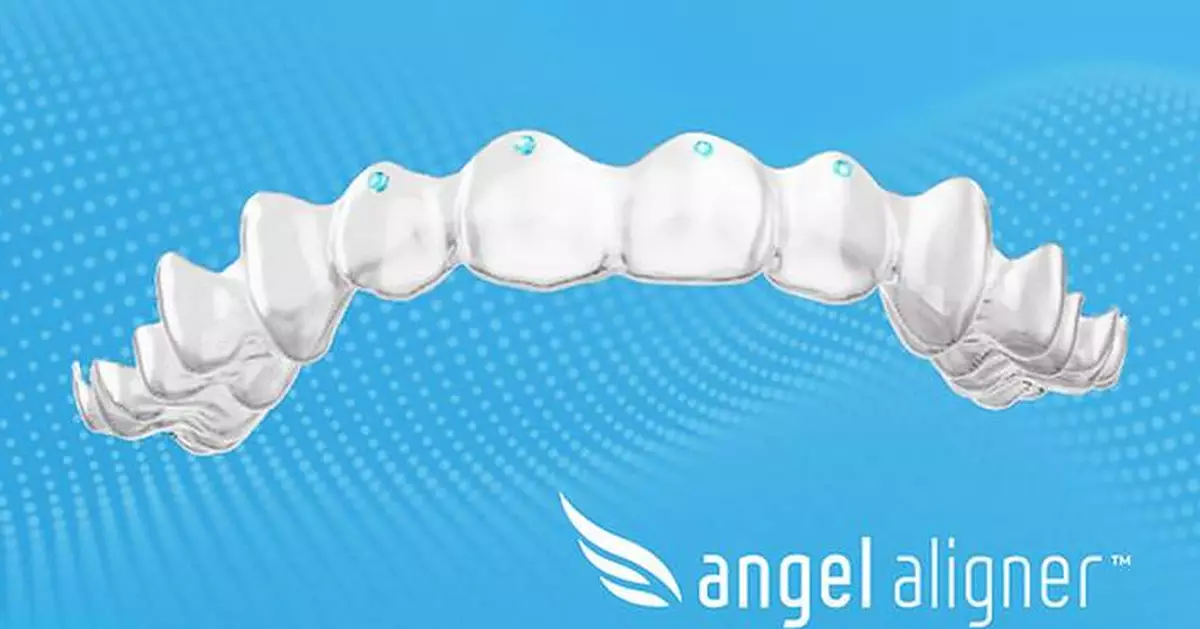 Paris Court Ruling on Discontinued Feature Will Have Minimal Impact on Angelalign Customers
