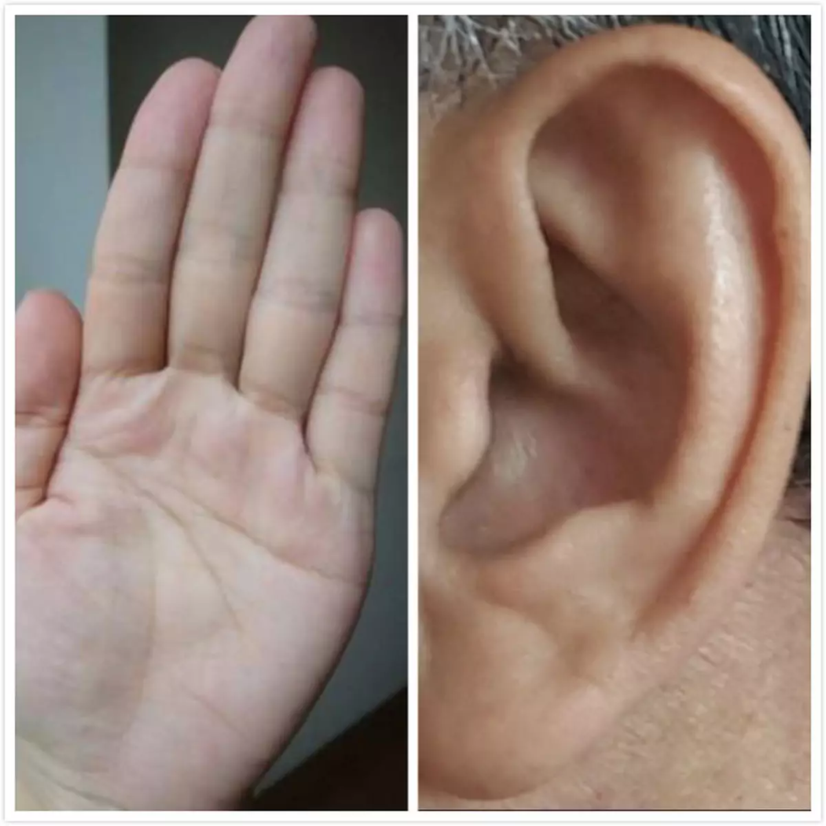 手診面診 輕鬆檢查血液循環