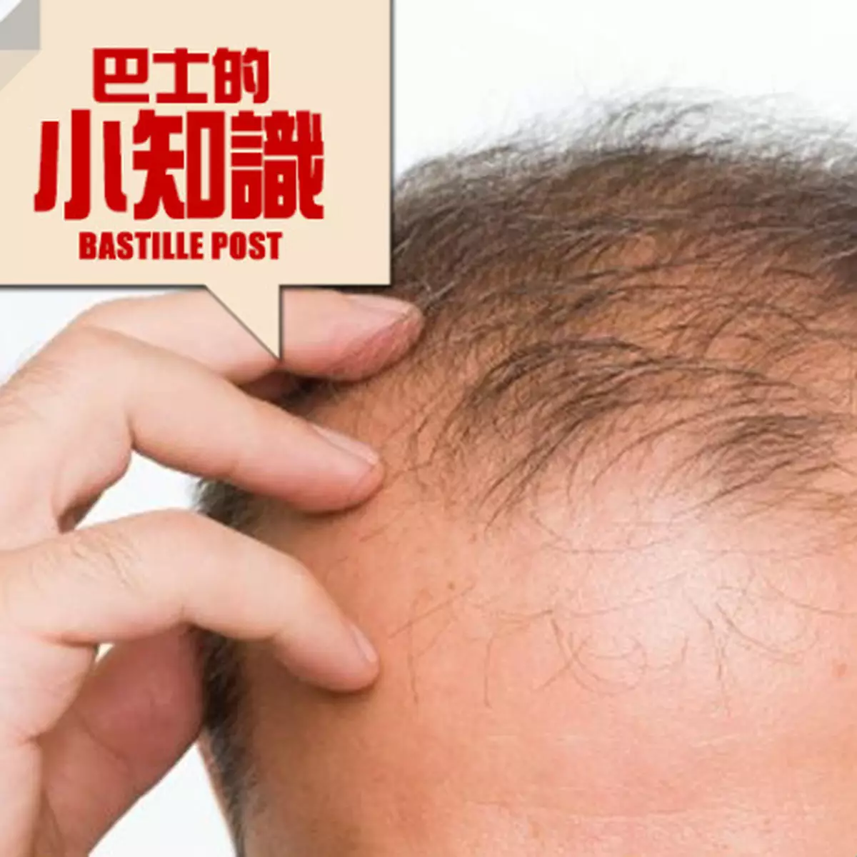 五大防脫髮要訣
