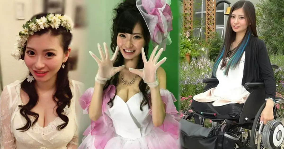 日美少女意外失雙腿 態度積極獲電影公司青睞