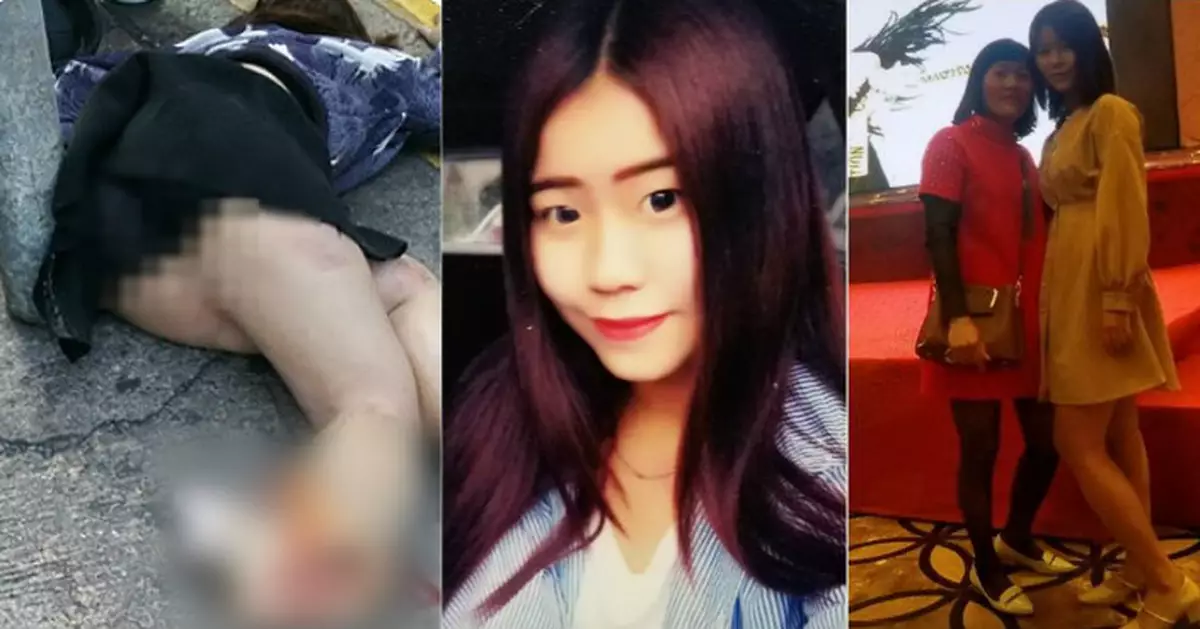 輾爆腳内地女或需全腿截肢  母憂難負擔醫療費