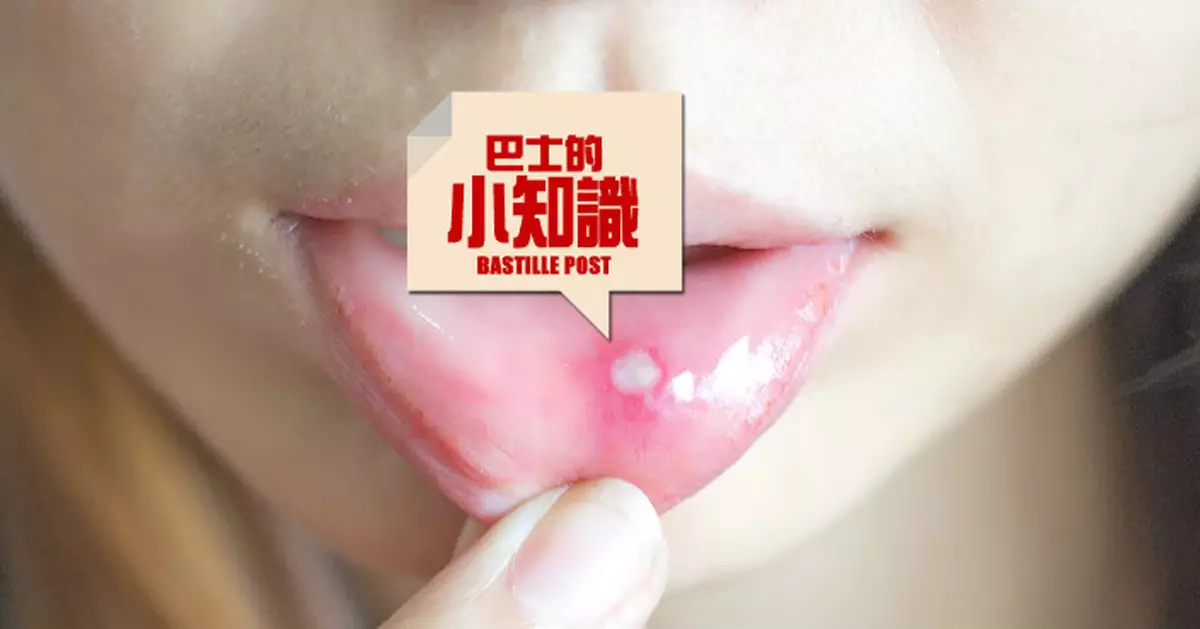 熱氣狂生痱滋點算好？4個小方法紓緩痛楚