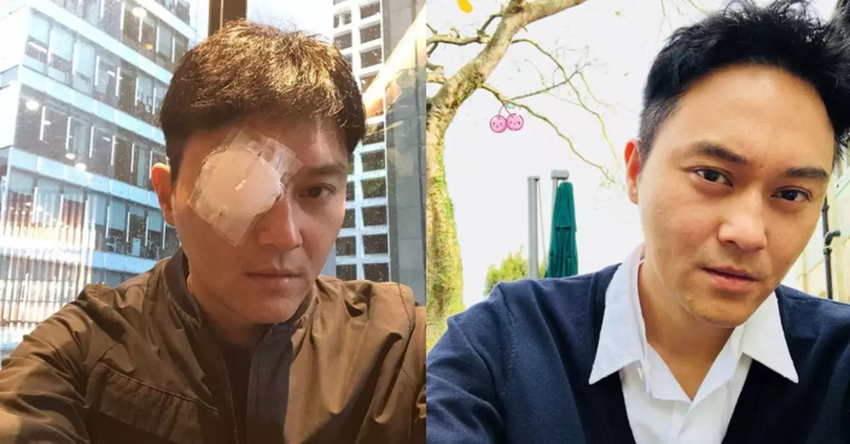 做矯視變「獨眼龍」 張智霖「單眼」獲讚型爆