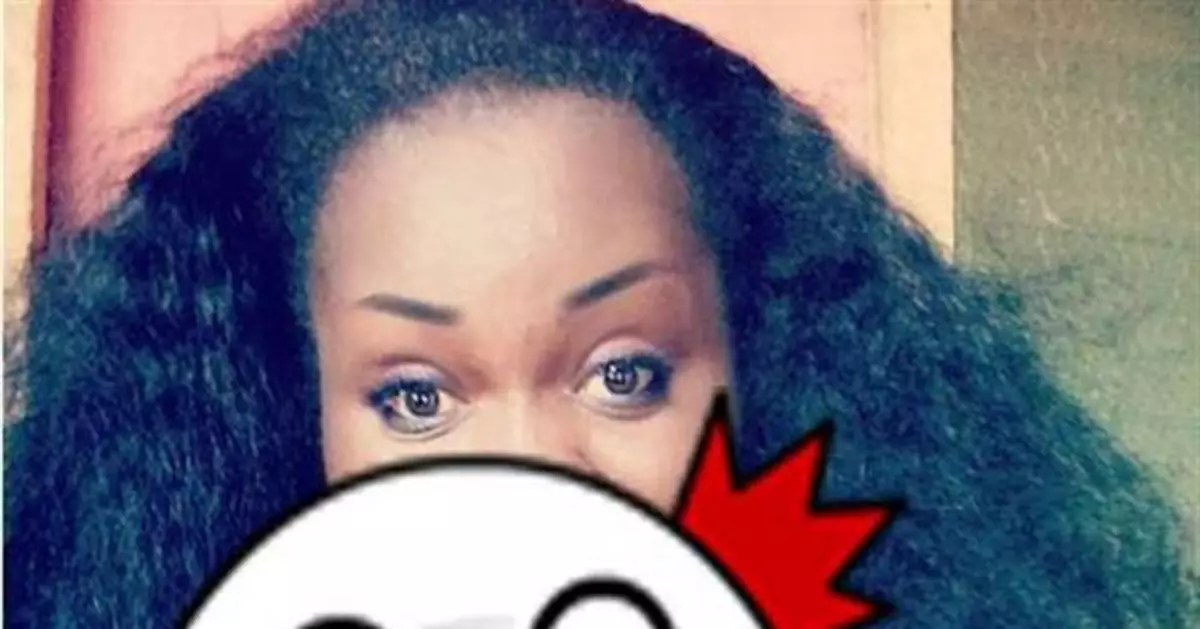 「毛髮最多」女上網尋愛 PO出照片網全歪樓