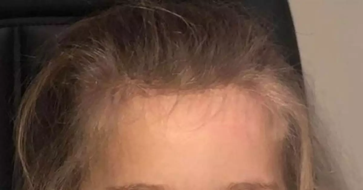 4歲女童瞳孔驚現詭異白點 一查竟是眼癌