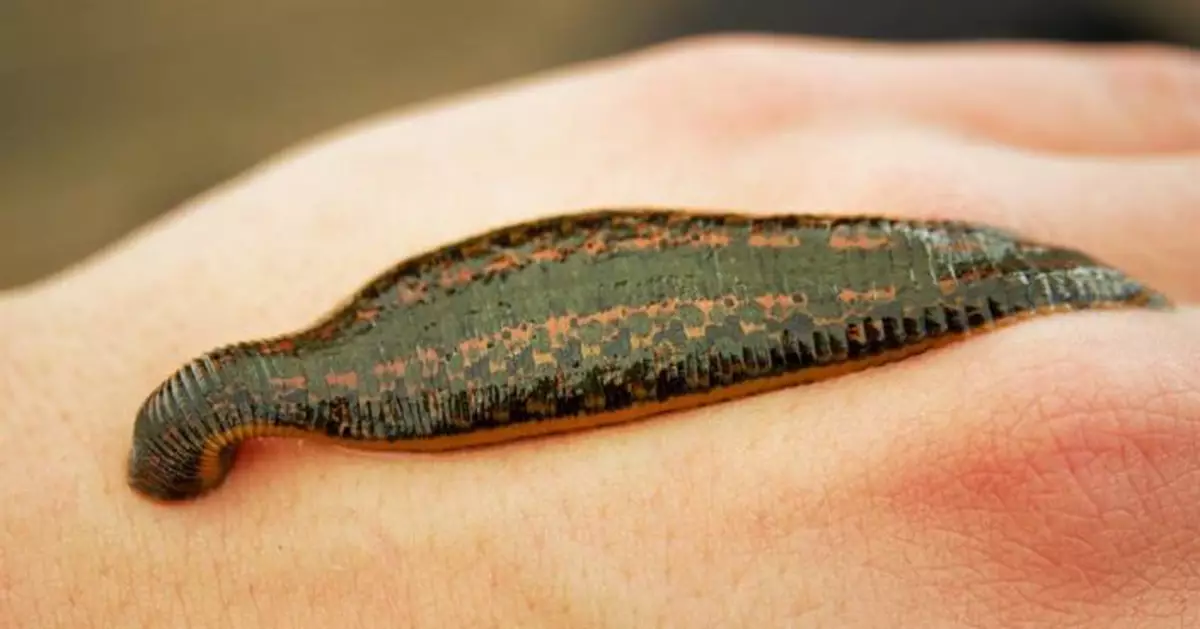 女童下體狂噴血！竟是被它吸到飽