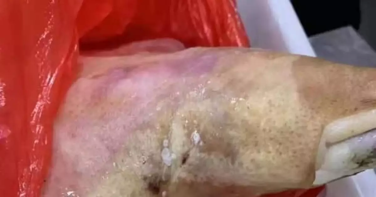 幼兒園食材發霉變質 園方：是給老師吃的！