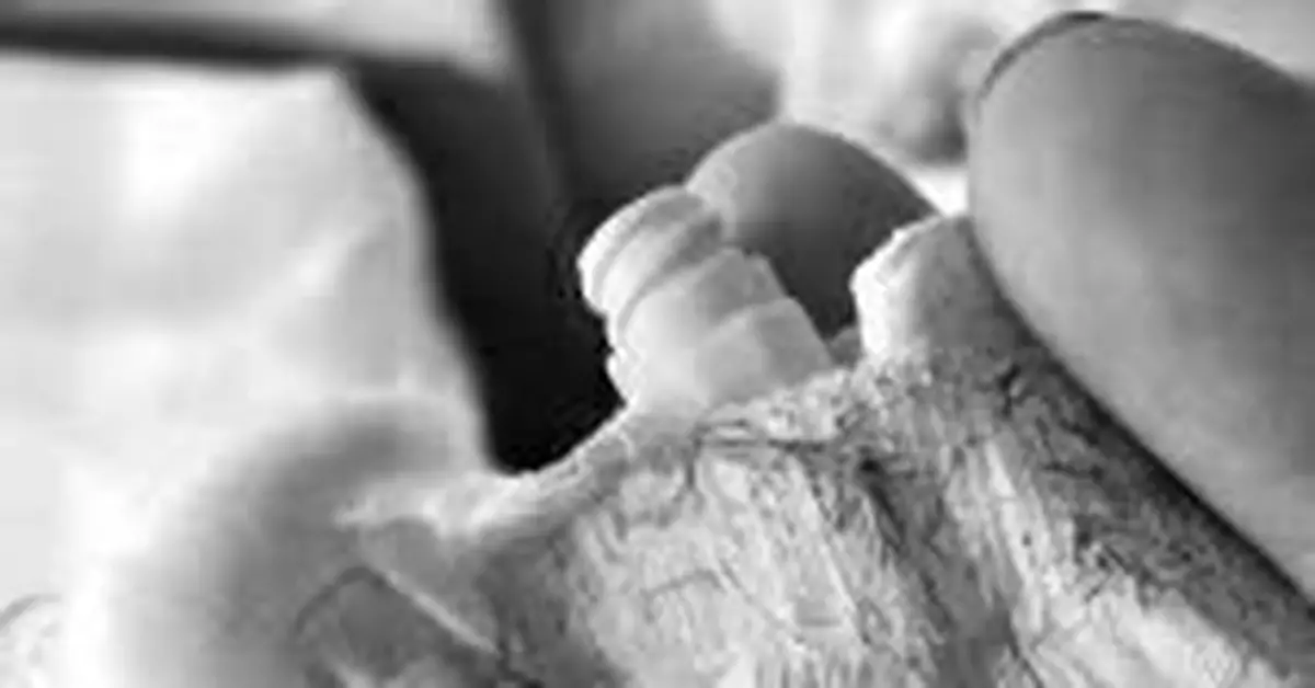 醫院手術後把針頭導管留嬰兒體內 快一年仍未找到