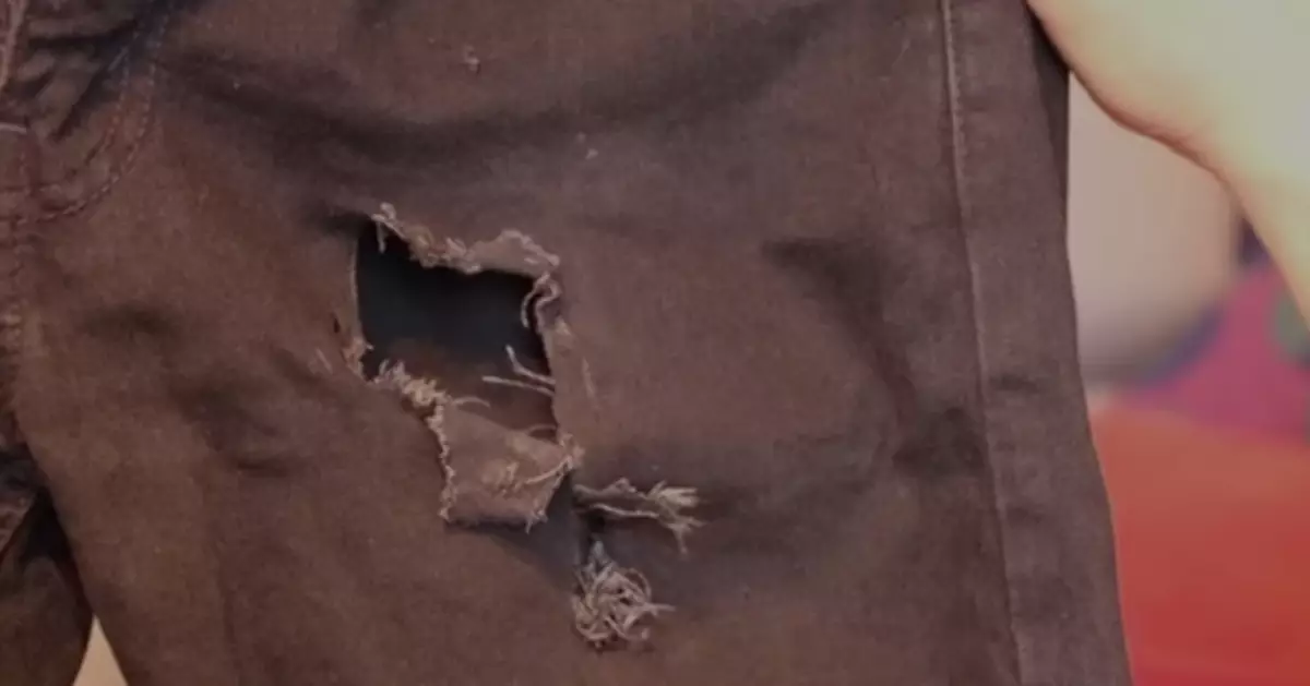 法國男子兜里電子煙突然爆炸 火星四濺慘遭燒傷