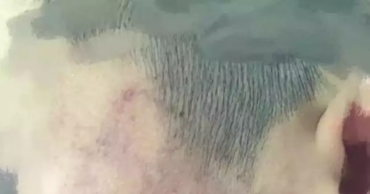 老師毆打學生被調離崗位，幾十名家長聯名請求調回