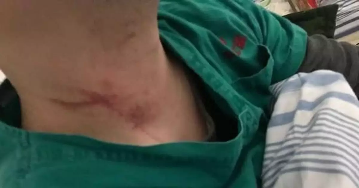 武漢2名抗疫醫生被患者家屬打傷防護服被撕扯