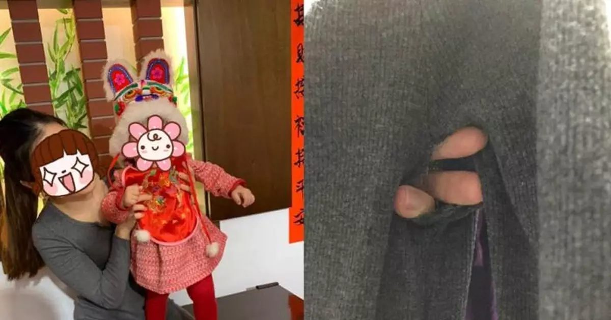 辣媽穿高衩緊身裙 破2大洞她羞爆