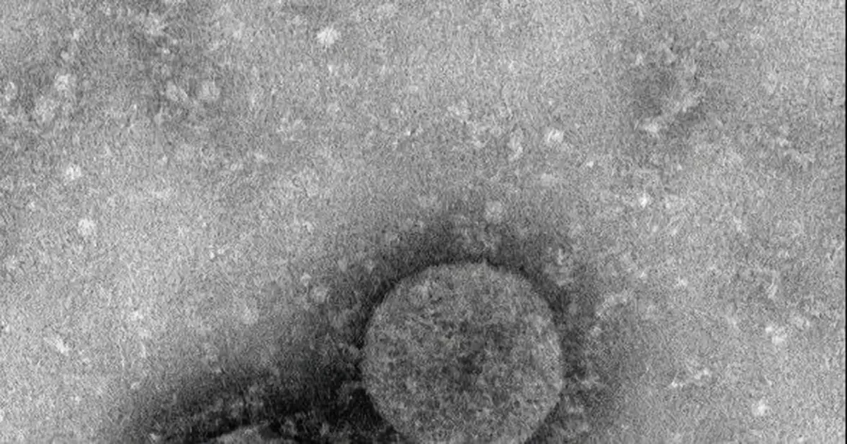 新冠病毒波及25個國家，它究竟長啥樣？