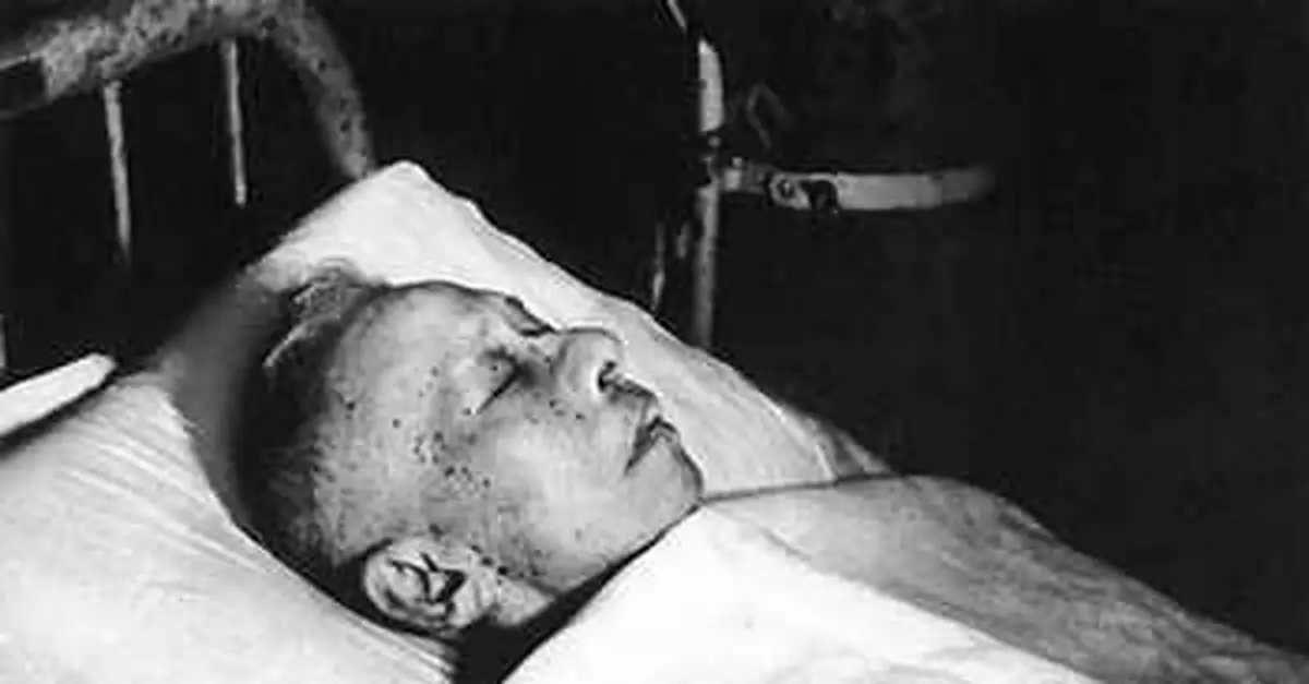 劉少奇文革慘狀：死時全身沒有一根好的血管