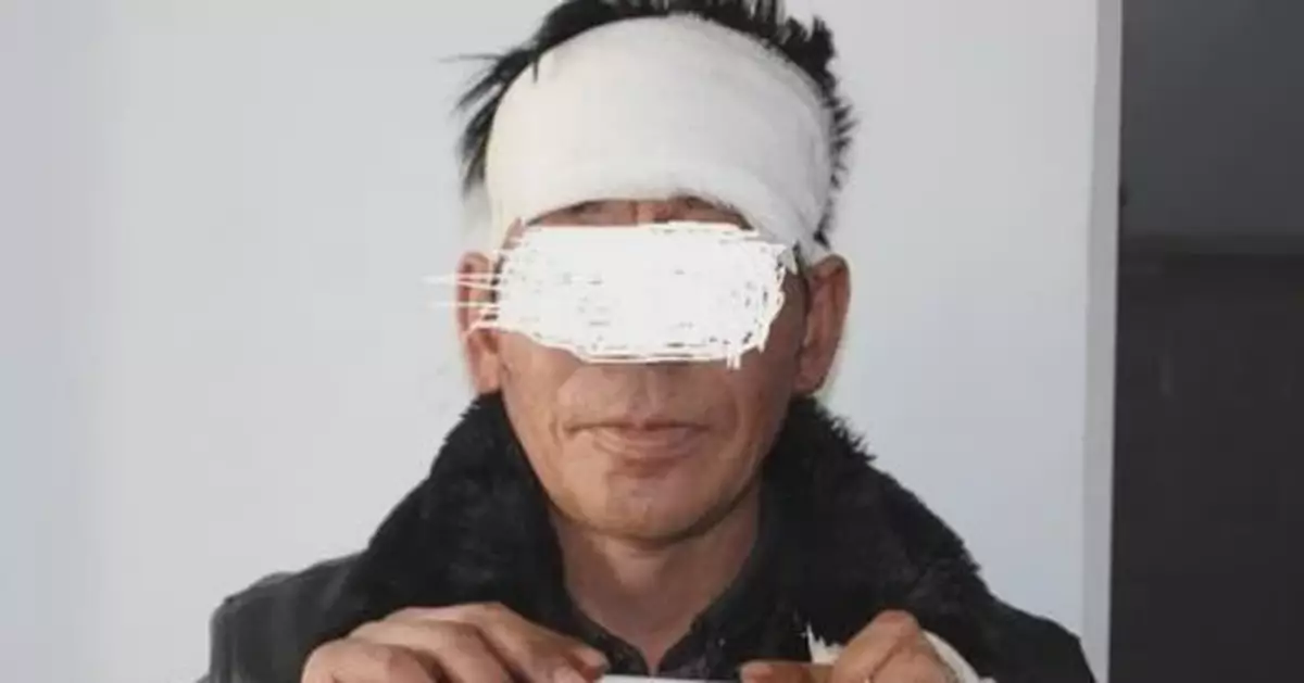 醉酒男子出車禍 在被救治時竟非禮毆打女醫護