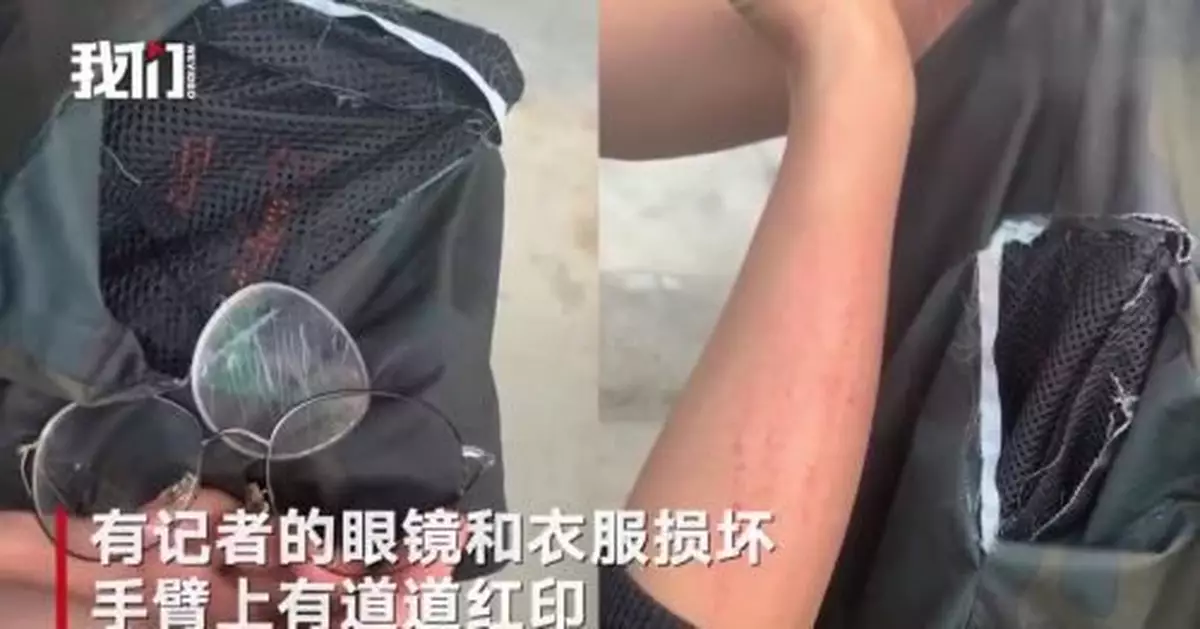 俠客島：毆打記者，究竟是跟誰叫板？