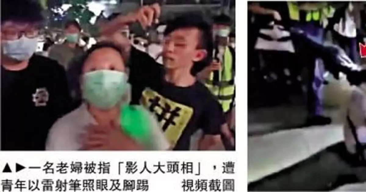 「大頭娃娃」事件涉事醫生被停職