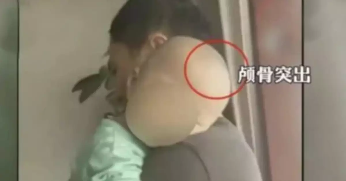 「大頭娃娃」重現 媒體：別放過作惡鏈的每一環