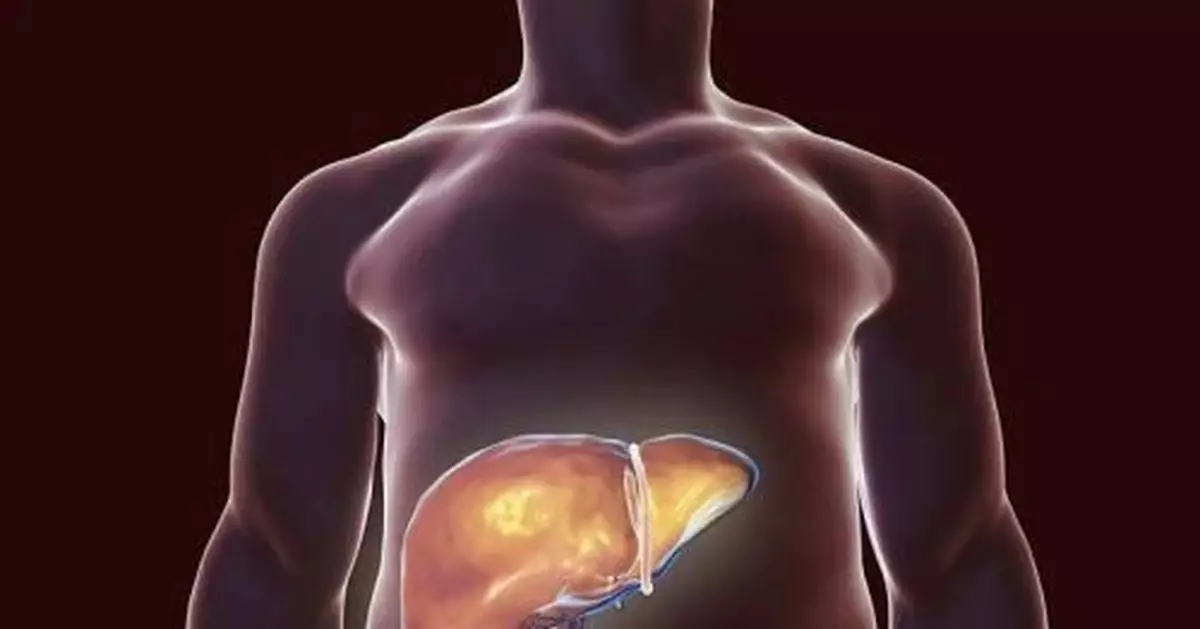 警惕！肝病都是拖出來的，早期無明顯癥狀！